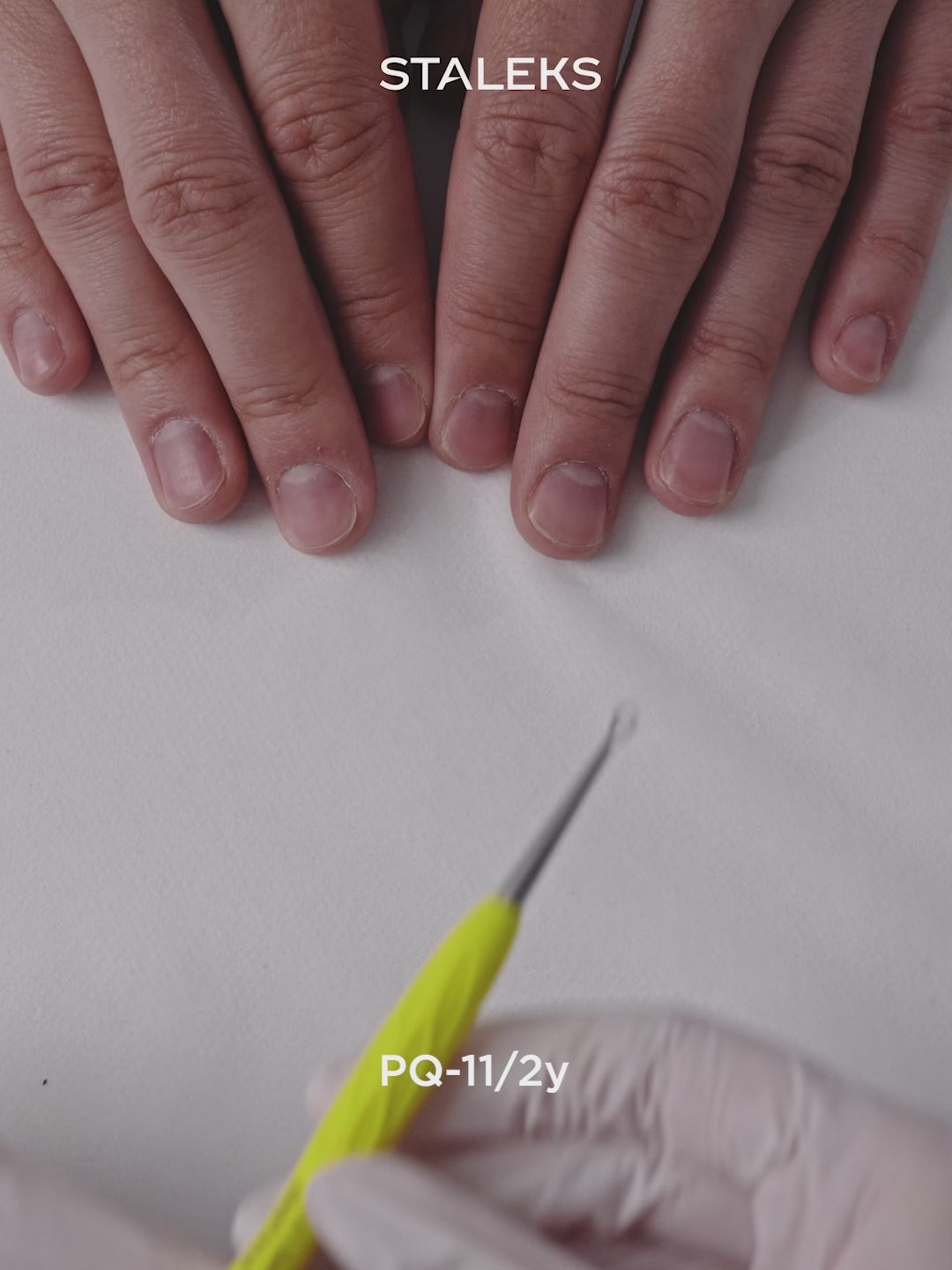 Load Video: STALEKS UNIQ 11 TYPE 2 Gummy Beveled and loop pusher